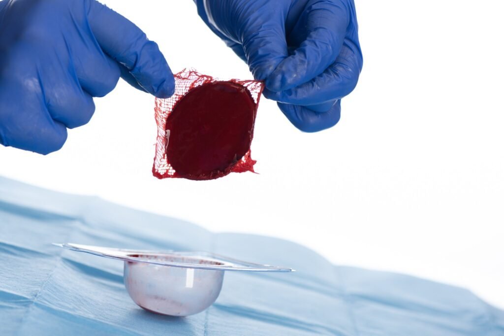 ActiGraft Pro in clinic