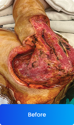 Clinical result before treatment