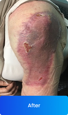 Clinical result after treatment